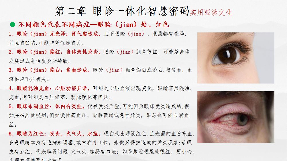 眼部疾病诊治 一体化智慧中医密码(图20)