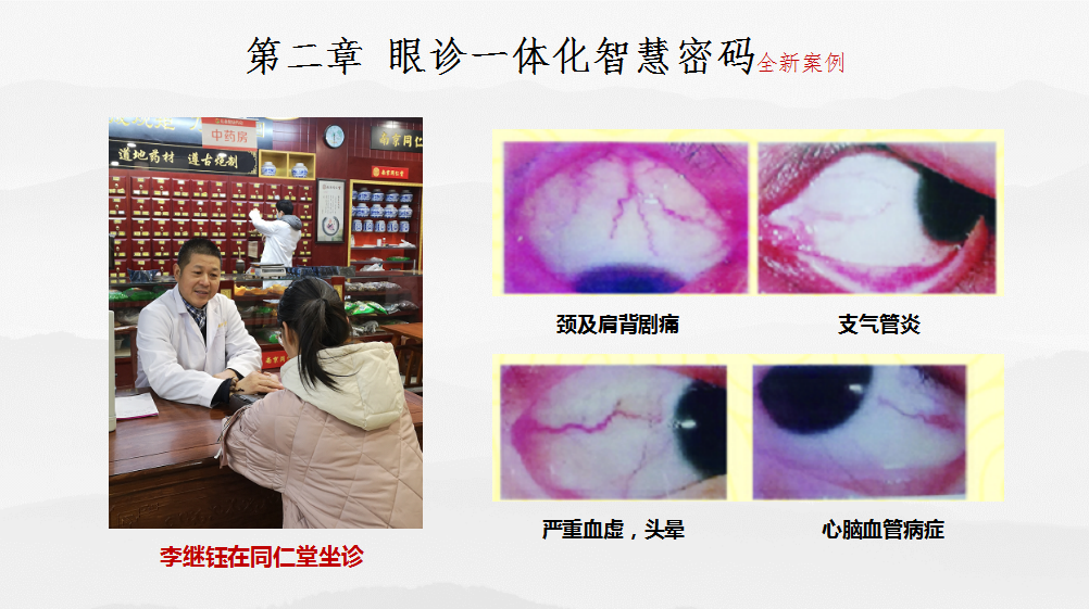 眼部疾病诊治 一体化智慧中医密码(图22)