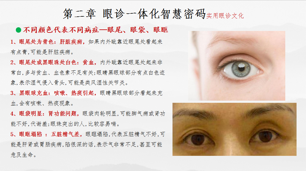 眼部疾病诊治 一体化智慧中医密码(图21)
