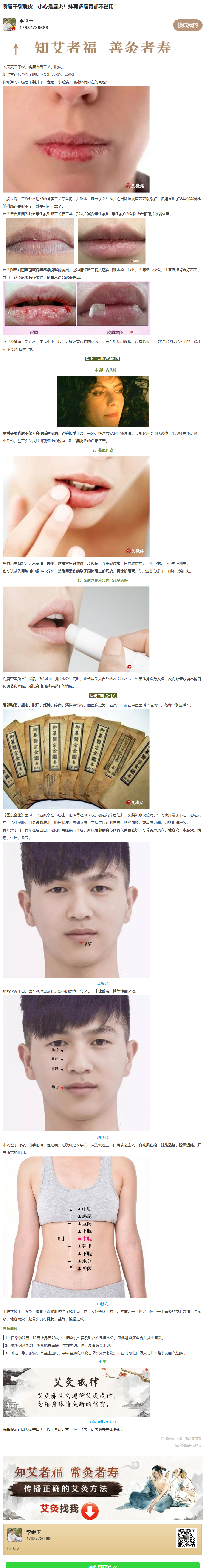 嘴唇干裂脱皮，小心是唇炎!抹再多唇膏都不管用!(图1)
